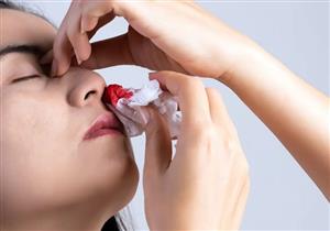 نزيف الأنف .. إليك الأسباب والإسعافات الأولية