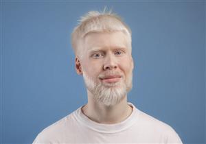 طبيب يحذر: الشمس تهدد هؤلاء بسرطان الجلد