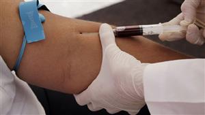 فحص دم بسيط يكشف عن  50 نوعا من أمراض السرطان