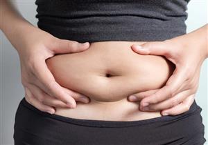هل يمكن التخلص من "الكرش"؟.. طبيب يوضح
