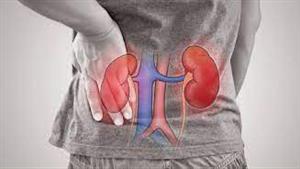 6 أكلات الإكثار في تناولها تلحق الضرر بالكليتين - لن تتوقعها