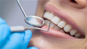 دراسة: العناية الجيدة بالأسنان تقلل خطر الإصابة بالخرف