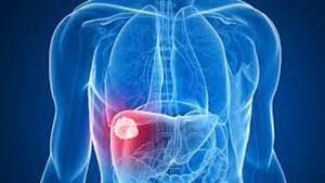 هذه الأعراض تنذر بمشاكل في الكبد