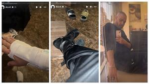 "في الجبس".. "أبيوسف" يكشف عن إصابته في أحدث ظهور على السوشيال ميديا