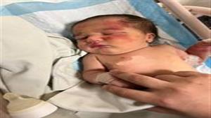 في لبنان.. العثور على طفلة في مكب نفايات بجانب فكي كلب