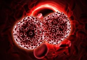  5 فئات أكثر عرضة لخطر الإصابة بسرطان الدم