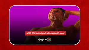 جدل بسبب أحمد الفيشاوي.. 4 طرق طبيعية لإزالة التاتو في المنزل