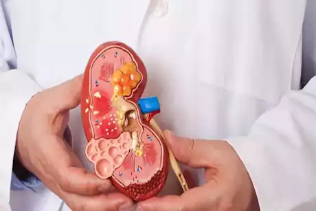 من أخطر 10 أمراض عالمياً… مرض قاتل يشهد زيادة مقلقة في الإصابات