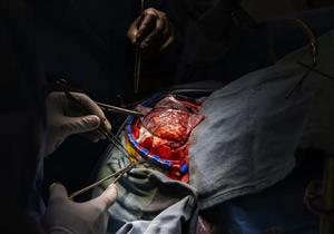 كيف تطور العلاج الجراحي لأمراض المخ؟- طبيب يوضح "فيديو"