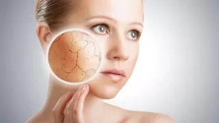 الأفوكادو: سر البشرة النضرة في الشتاء