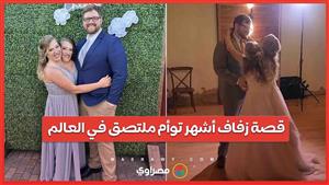 رأسان في جسد واحد .. قصة زفاف أشهر توأم ملتصق في العالم