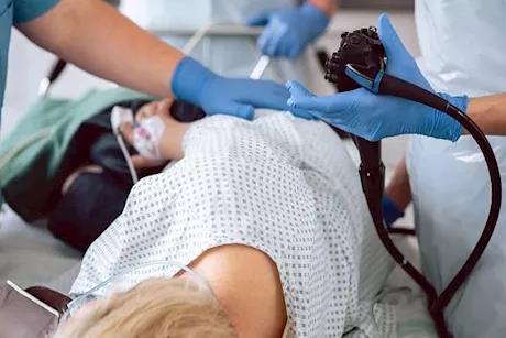 فئات ممنوعة من منظار القولون.. هل أنت منهم؟