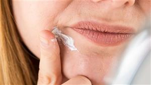 ما أسباب التجاعيد الأنفية الشفوية؟ إليك الحلول 