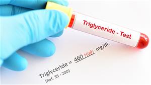 هذا ما يحدث لك عند ارتفاع مستوى الصوديوم في الجسم