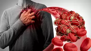 دراسة: الألياف تحمي من انسداد الشرايين ومضاعفاته الخطيرة