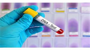 شاب يكتشف سرا غير متوقع بعد اختبار حمض نووي لخطيبته.. مفاجأة