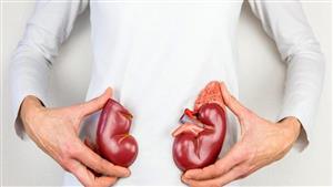 4 أطعمة تسبب حصوات الكلي وتدمر الكبد