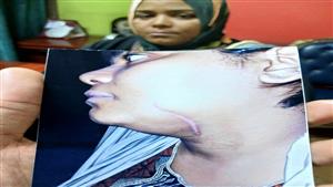 ضرب مراته بسكين المطبخ  قدام بناته والجيران .. حكم قضائي ضد عاطل الهرم