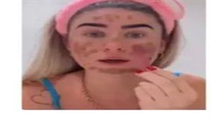 عارضة أزياء تضع "أغرب قناع" على وجهها: "سمعت أنه يمنع الشيخوخة" (فيديو)