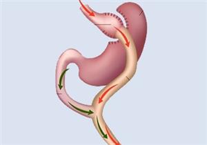حسام موافي يوضح المشكلات الشائعة بعد عملية تحويل المسار