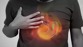 كيف تتخلص من الحموضة بعد الفسيخ والرنجة؟