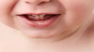 تحذير من استخدام عضاضات تخفيف آلام تسنين الأطفال في حالات محددة