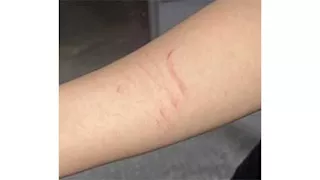 بالصور.. أول رد من "التعليم" بشأن الاعتداء على طالب بمدرسة في شبرا