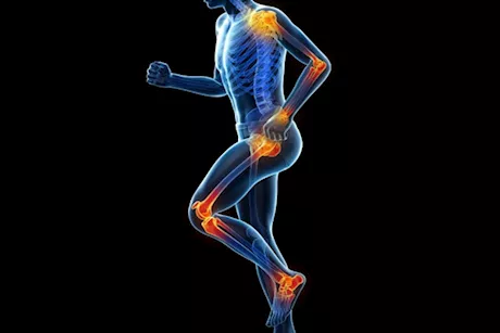 انتبه- 10 علامات تكشف عن وجود التهاب خفي بجسمك