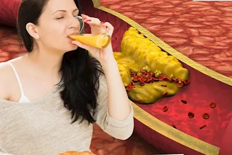 لحماية شرايينك من التصلب- تناول هذه المشروبات يوميًا