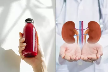 وظائف كليتيك بطيئة؟- 8 مشروبات لتحسينها