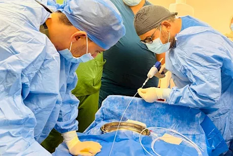 بدون تدخل جراحي.. نجاح 5 عمليات بتقنية الصمغ الطبي وبالتخدير الموضعي.. التفاصيل من بور سعيد 