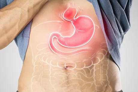 تعاني فتق الحجاب الحاجز؟.. تناول هذه الأطعمة