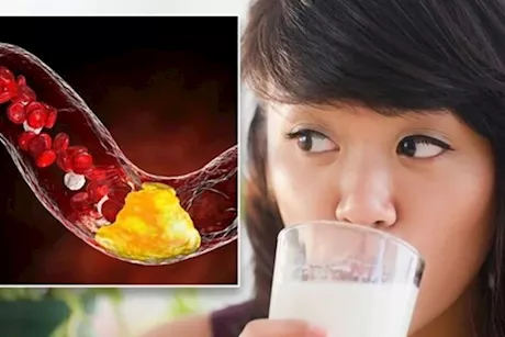 تأثير حليب جوز الهند على الكوليسترول- يرفعه أم يخفضه؟