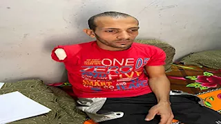 "محمد خرج يدور على رزقه رجع بعاهة".. شاب من المنوفية يفقد ذراعه في أول يوم عمل- صور