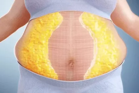 لحرق دهون البطن في 15 يومًا- اتبع هذه النصائح