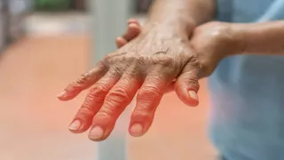 بالأسماء والأسعار- إليك أفضل 9 أدوية لتقوية الأعصاب