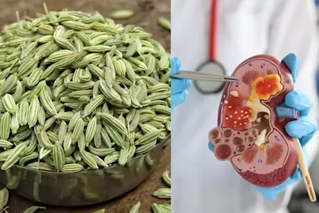 الشمر الكلى- 3 فوائد يقدمها لصحتها