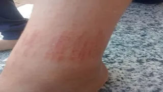 معلمة تعتدي بالضرب على تلميذ ابتدائي بطوخ.. الأم: ابني يتيم ولن أتنازل عن حقه 