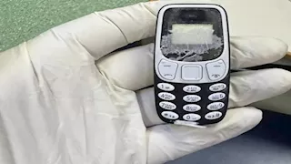 بعد 11 شهرًا.. استخراج هاتف محمول من معدة مريض بالمنصورة (صور)