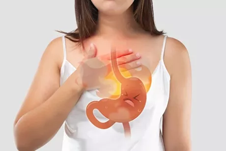 زوركال وأنتودين- أيهما أفضل لعلاج ارتجاع المريء؟