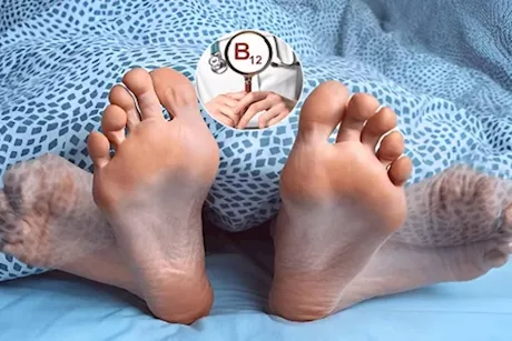 بعد الخمسين- 8 أعراض لنقص فيتامين B12 تظهر على القدمين ليلًا