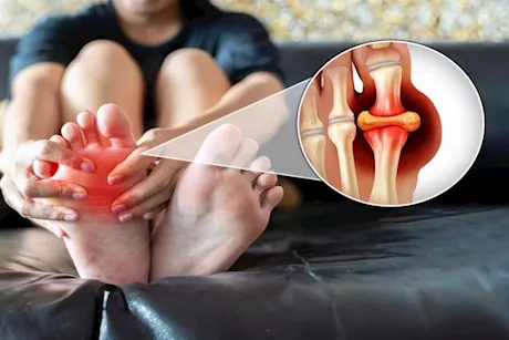 لعلاج ارتفاع حمض اليوريك في شهر- تناول هذه الخضراوات يوميًا