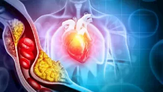 دواء جديد يقلص الكوليسترول الضار بنسبة تصل إلى 60%