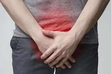 سرطان البروستاتا في المرحلة الرابعة- هل يمكن الشفاء منه؟