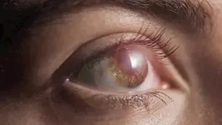 كيف يساعد تناول الأطعمة الغنية بالبوليفينولات على تقوية البصر؟