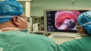 رجل صيني يعيش بـ ولاعة في معدته لمدة 30 عاما.. ماذا حدث له؟