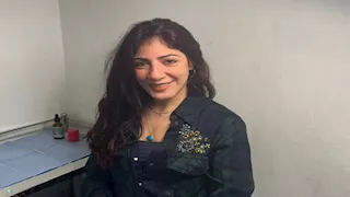 خبيرة تجميل تكشف عن تقنية جديدة لعلاج الإصابة بالثعلبة 