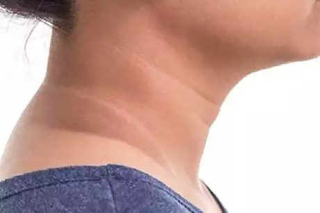 هل شرب الحليب على الريق يزيد من الإصابة بمقاومة الإنسولين؟