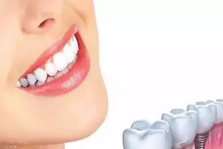 للحفاظ على أسنان قوية.. 7 عادات يومية يجب اتباعها 