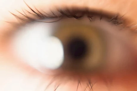 طبيب يحذر: هذه الأدوية قد تصيبك بالعمى